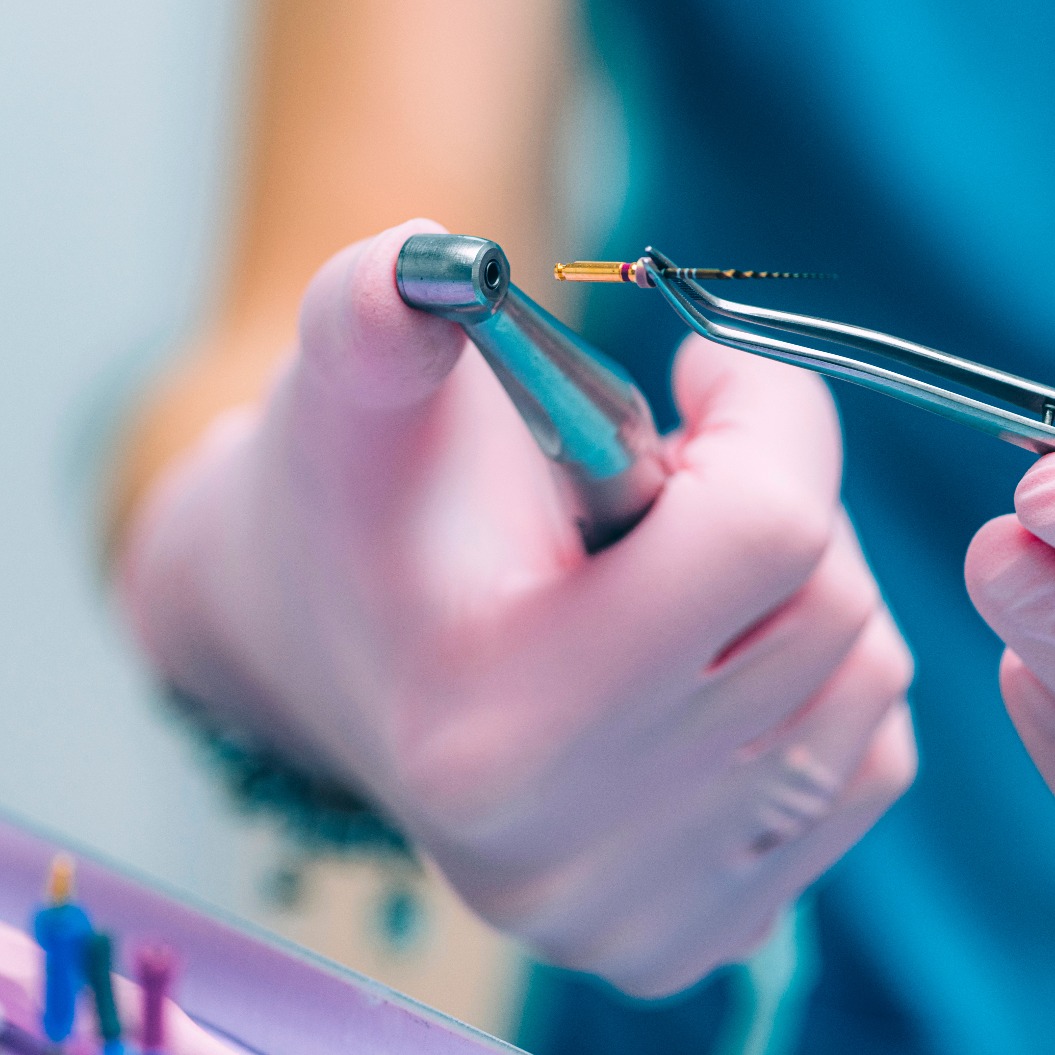 Ein Endodontologe mit einer gezackten Bohrspitze, Wurzelkanalbehandlung in einer Zahnarztpraxis.