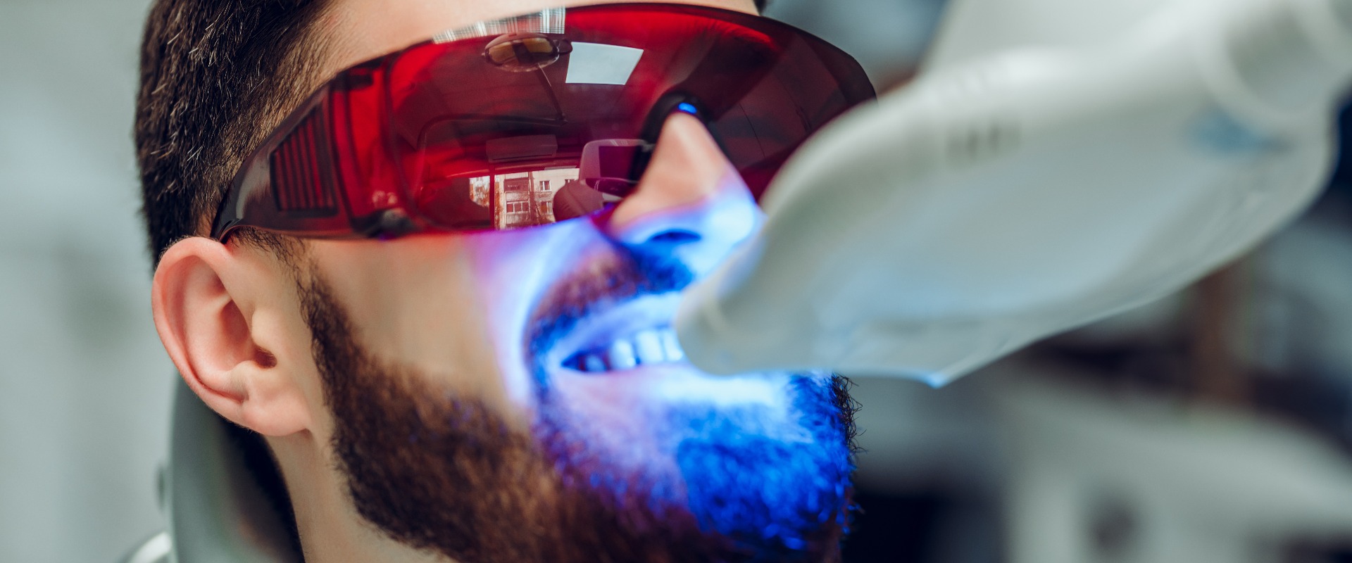 Ein Mann, der sich mit einem zahnärztlichen UV-Zahnaufhellungsgerät die Zähne aufhellen lässt; eine Zahnarzthelferin, die sich um den Patienten kümmert; die Augen sind durch eine Schutzbrille geschützt. Zahnaufhellungsbehandlung mit Licht, Laser und Fluorid.