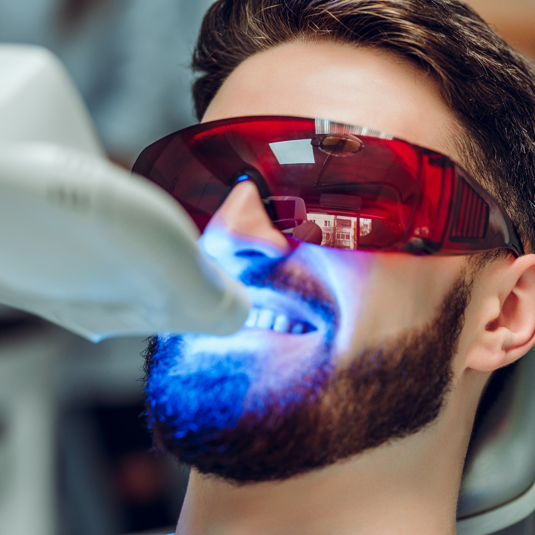 Ein Mann, der sich mit einem zahnärztlichen UV-Zahnaufhellungsgerät die Zähne aufhellen lässt; eine Zahnarzthelferin, die sich um den Patienten kümmert; die Augen sind durch eine Schutzbrille geschützt. Zahnaufhellungsbehandlung mit Licht, Laser und Fluorid.